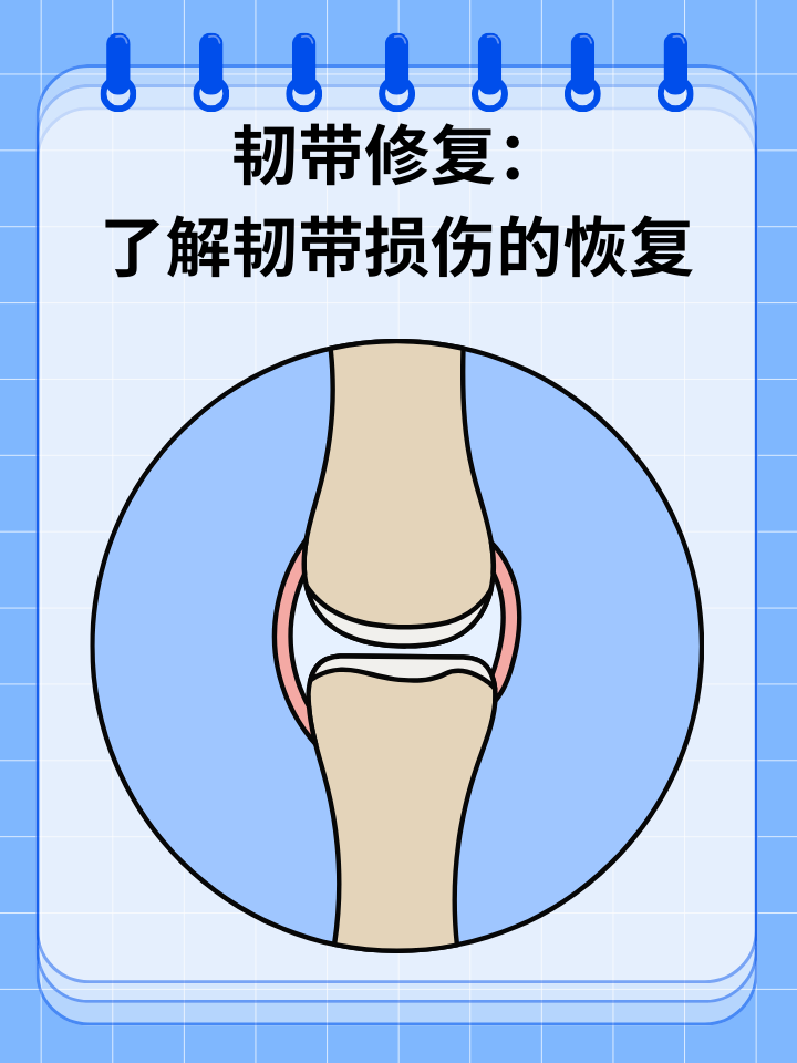 恢复与修复的区别 修复和修复是一样的吗 
